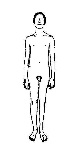 schizoid: körperliche Erscheinung